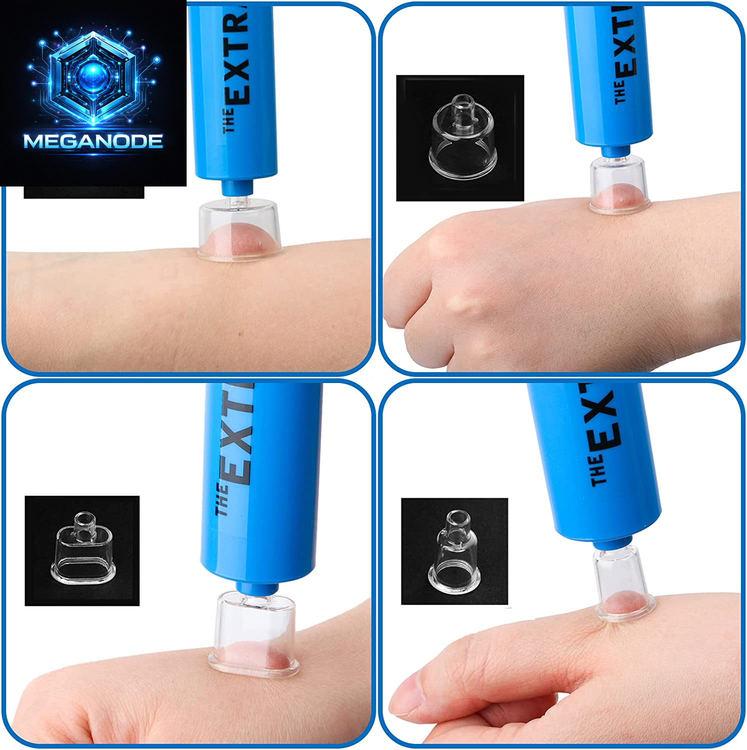 Snake Bite Kit, Bee Sting Kit, Emergency First Aid Supplies